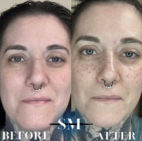 Shannon Maglione - Permanent Cosmetics - Freckles